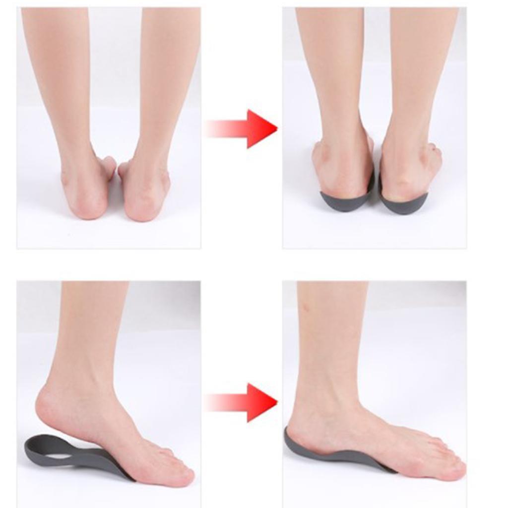 Arch Support Insole Leg Correction Flat Foot EVA Unisex Gel Pad Shoes Pad Shoes