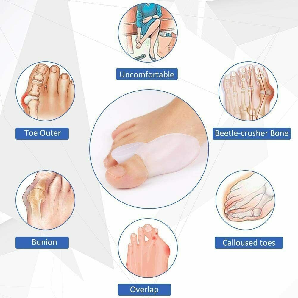 CLEARANCE- 2pcs Silicone Gel Bunion Protector