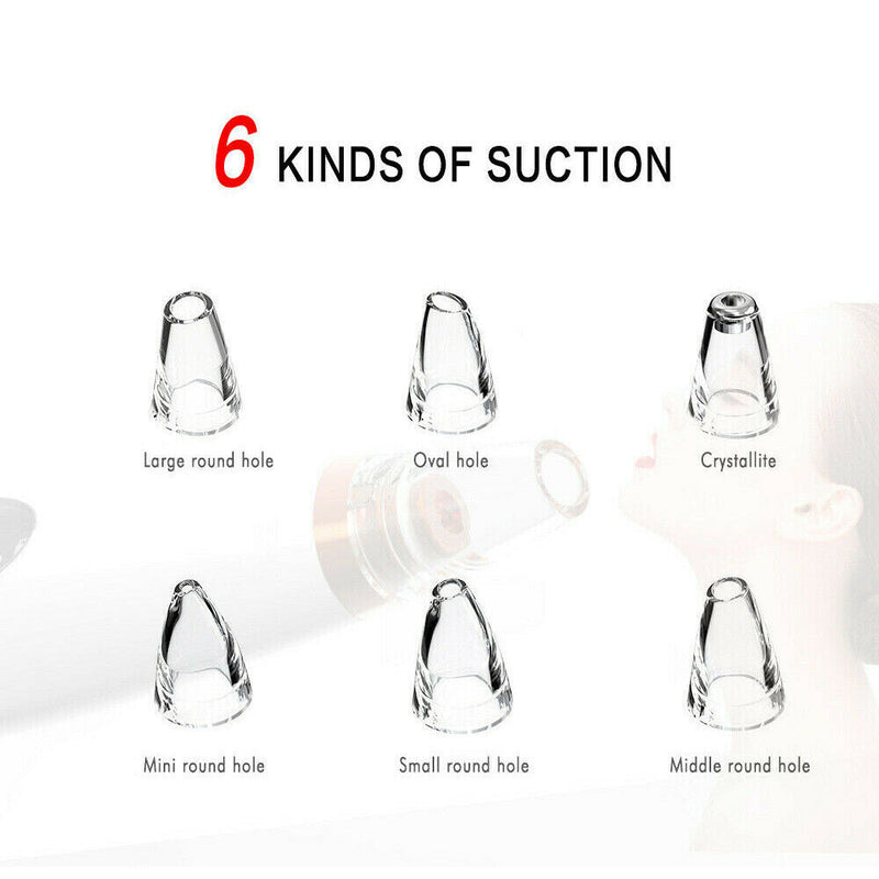 Free shipping-6 in 1 Electric Facial Blackhead Remover