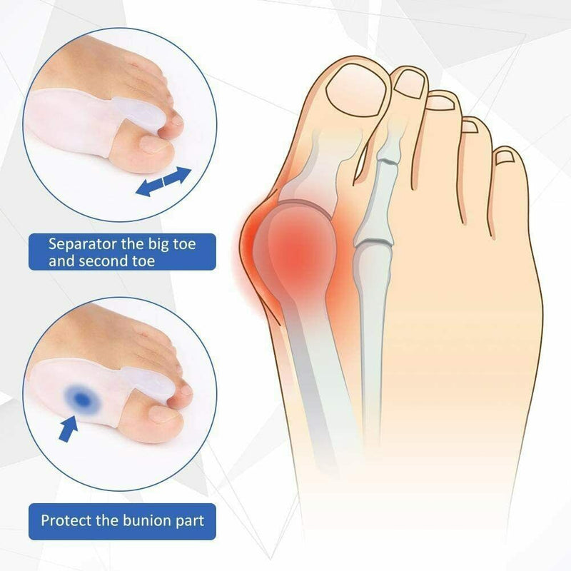 2pcs Silicone Gel Bunion Protector